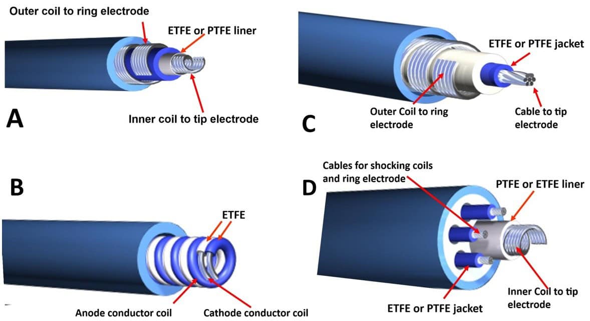 Articles in Heart Rhythm highlight the urgent need to distinguish between harmful per- and polyfluoroalkyl substances (PFAS) and essential fluoropolymers, which are used in medical technology. This image demonstrates the use of fluoropolymers poly(ethylene-tetrafluoroethylene) (ETFE) and polytetrafluoroethylene (PTFE) in common cardiac implantable electronic device (CIED) lead constructions. A. Coaxial pacing lead; B. Coradial pacing lead; C. Lumenless pacing lead; D. Implantable cardioverter-defibrillator (ICD) lead. (Credit: Heart Rhythm / Vatterott et al.)