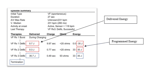 Medtronic: Safety Alert on ICDs